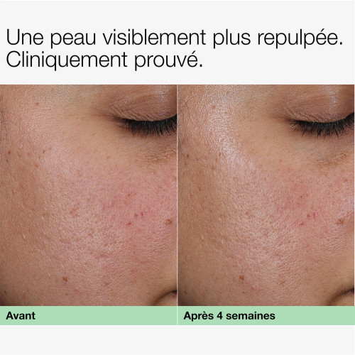 Smart Clinical Repair™ - Crème Collagène + PDRN Clinique Smart Clinical Repair™ - Crème Collagène + PDRN Clinique